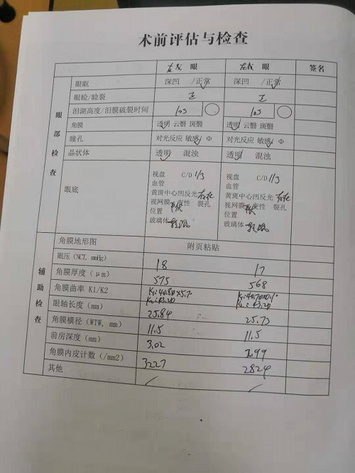 ICL晶体植入分享