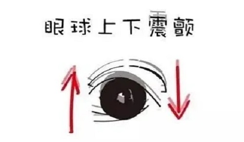 眼睛总是晃个不停是眼球震颤吗？